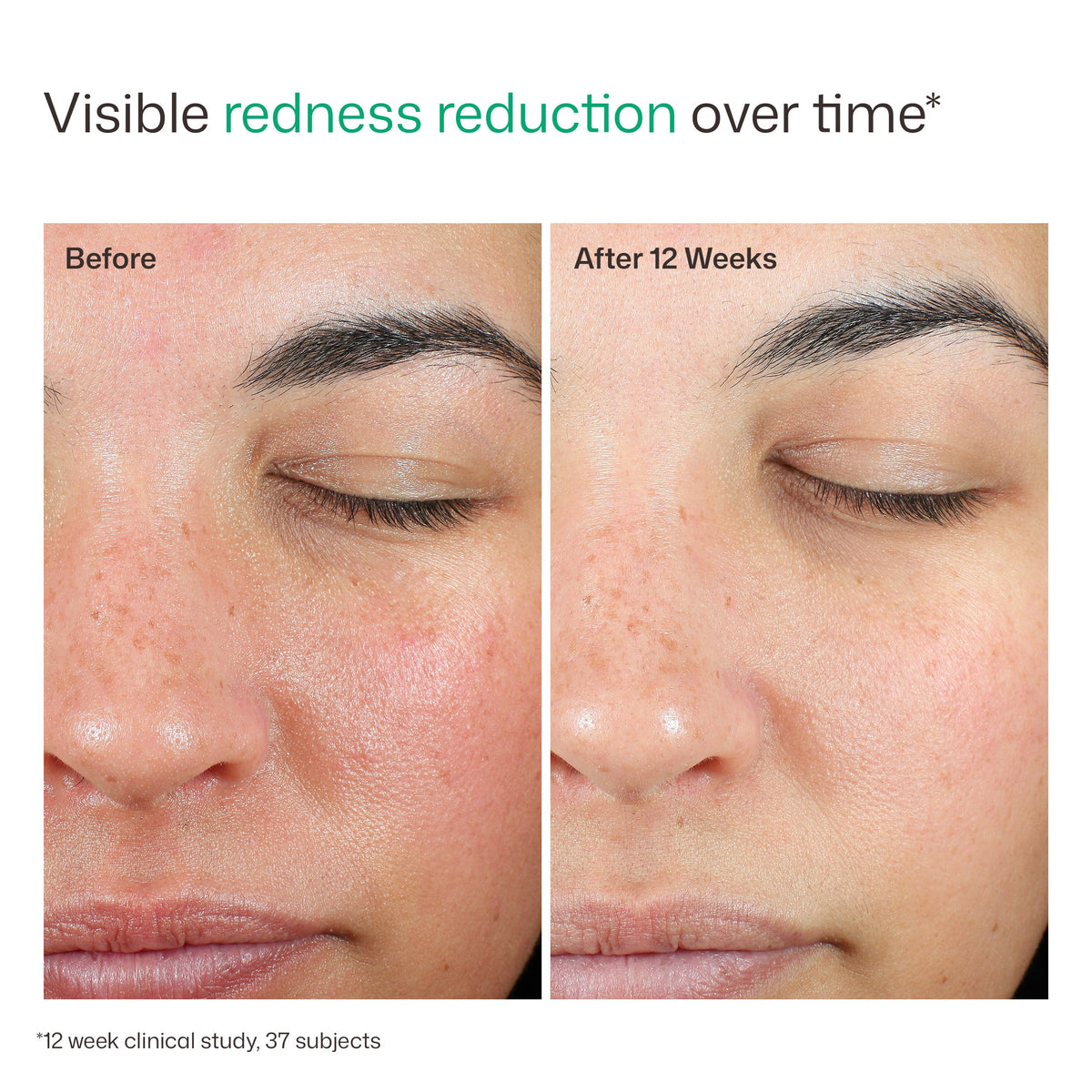 Green Tint Colour-Correcting Sunscreen SPF 50