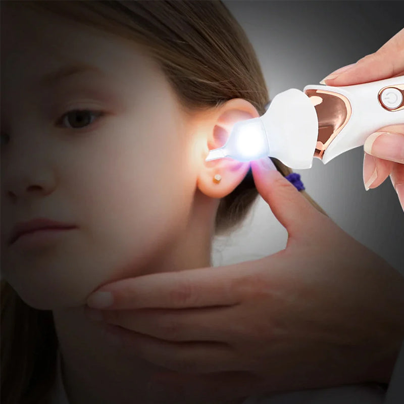 5 in 1 Electric Earwax Remover.