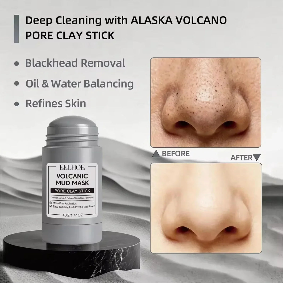 Clay Mask Stick for Deep Pore Cleansing – Kaolin Face Mask with Roller Ball Applicator