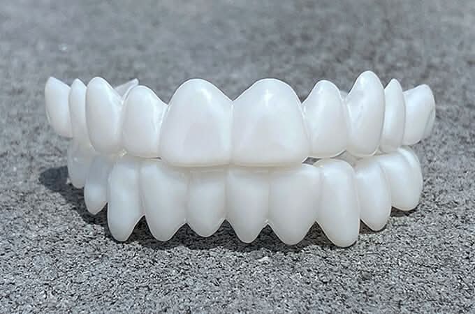 Natural-Look Dental Veneer for Everyday Confidence