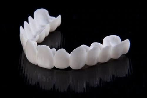 Natural-Look Dental Veneer for Everyday Confidence