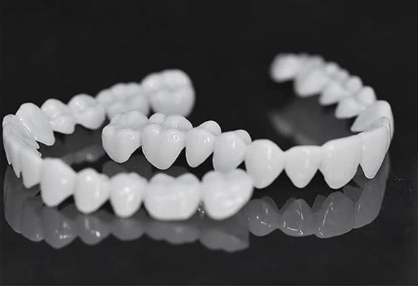 Natural-Look Dental Veneer for Everyday Confidence